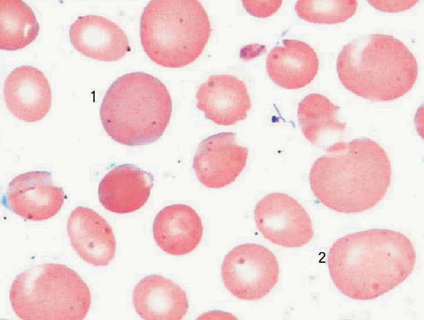 大红细胞和巨红细胞